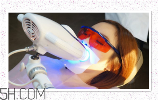 超聲波洗牙可以美白牙齒嗎？超聲波洗牙多少錢一次？