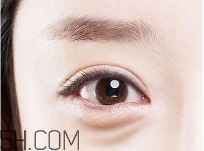 超聲法去眼袋效果好不好？超聲刀可以去除眼袋嗎？