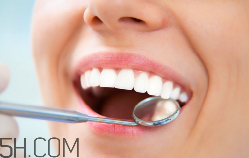 哪些情況不宜洗牙？洗牙后要注意什么？