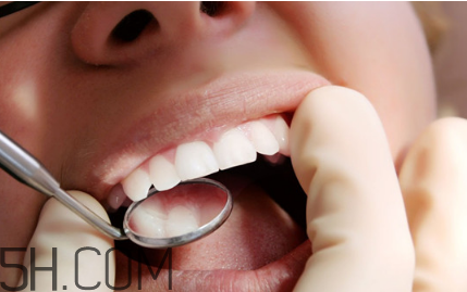 洗牙后牙縫變大是怎么回事？怎么保持牙齒潔白？