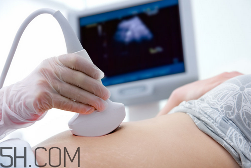 b超是檢查什么的？做b超時肚子上涂的是什么？