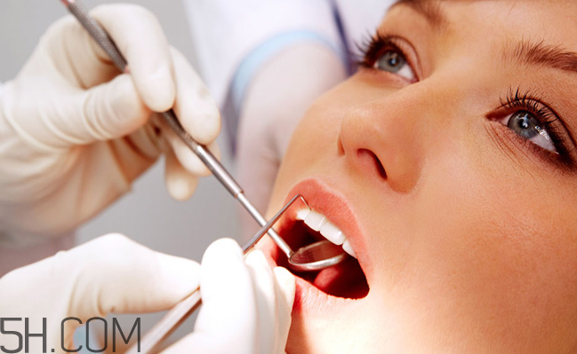 哪些情況不宜洗牙？洗牙后要注意什么？