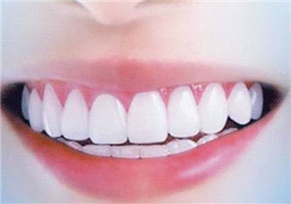 怎么用牙線？預(yù)防牙齒黃的方法