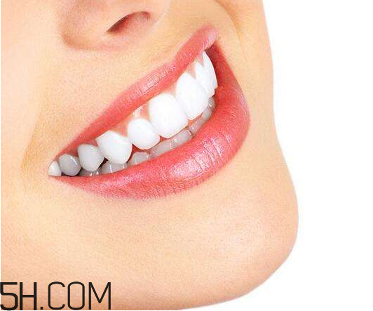 烤瓷牙為什么會有縫隙？烤瓷牙的注意事項有哪些？