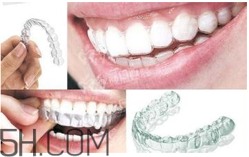 牙套的作用 牙套要戴多久 牙套的作用 牙套要戴多久