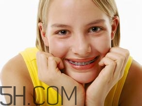 補牙需要帶牙套嗎？補牙后要裝牙套多少錢？