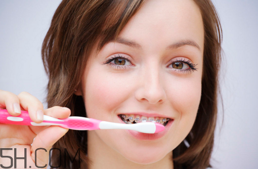 戴牙套可以懷孕嗎？牙齒矯正的后遺癥