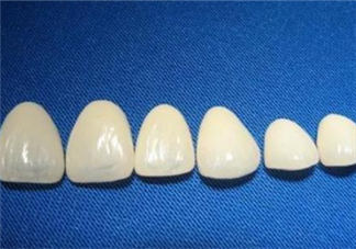 牙齒做貼面多少錢一顆？烤瓷牙可以取下來嗎？