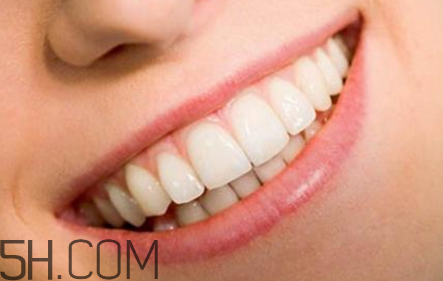 牙齒做貼面多少錢一顆？烤瓷牙可以取下來嗎？