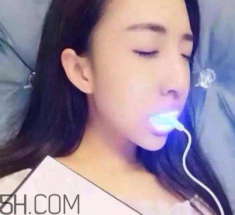 美牙儀可以兩個(gè)人用嗎？美牙儀用多久才有作用？