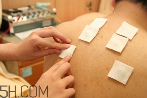 三九貼和三伏貼配方一樣嗎 三九貼和三伏貼的中藥配方 三九貼和三伏貼配方一樣嗎 三九貼和三伏貼的中藥配方