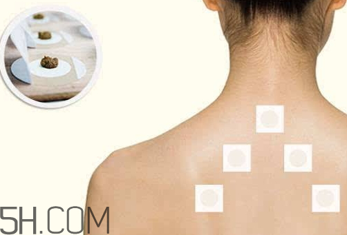 三九貼和三伏貼配方一樣嗎 三九貼和三伏貼的中藥配方 三九貼和三伏貼配方一樣嗎 三九貼和三伏貼的中藥配方