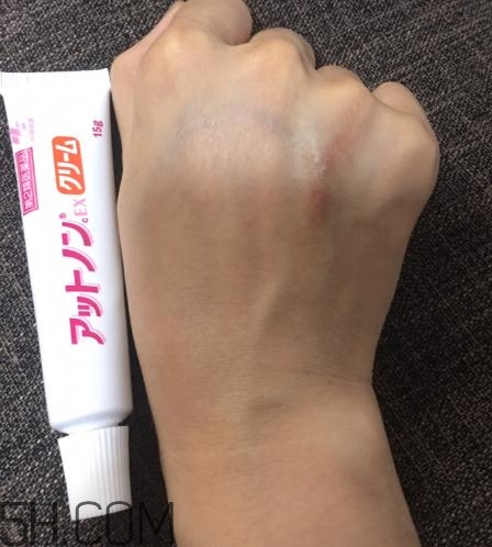 小林制藥祛疤膏有效嗎？小林制藥祛疤膏怎么樣？