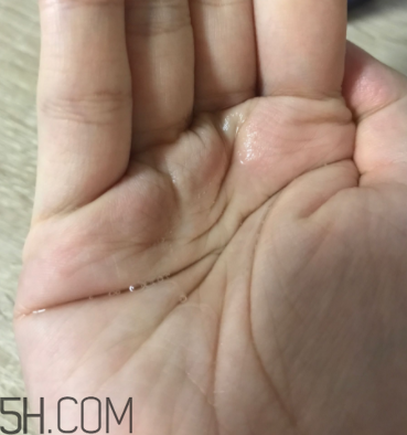 雪肌精卸妝油糊眼睛嗎？雪肌精卸妝油悶痘嗎？