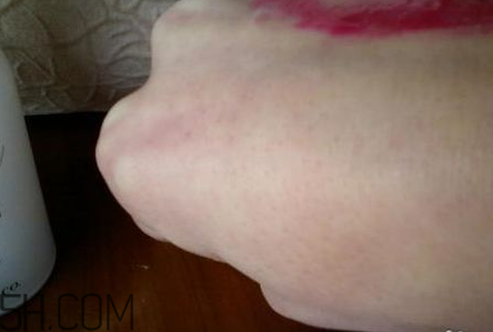 芭妮蘭卸妝膏用了長閉口怎么辦？芭妮蘭卸妝膏孕婦可以用嗎？