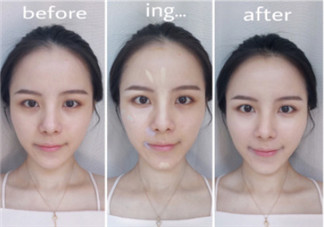 遮瑕膏前用什么 如何用遮瑕膏