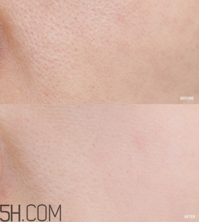 蘭蔻小黑瓶小嫩膜和前男友面膜哪個好？