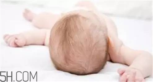 寶寶濕疹媽媽吃哪些食物比較好？寶寶秋冬脫發(fā)要怎么辦？