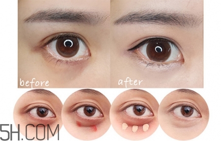 如何區(qū)分黑眼圈顏色 黑眼圈用什么顏色遮瑕 如何區(qū)分黑眼圈顏色 黑眼圈用什么顏色遮瑕