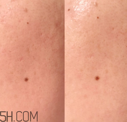 蘭蔻美膚修護(hù)美容液可以代替乳液嗎？什么功效？