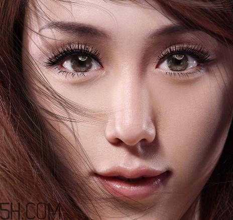 上瞼提肌手術有必要嗎？上瞼提肌后是永久的嗎？