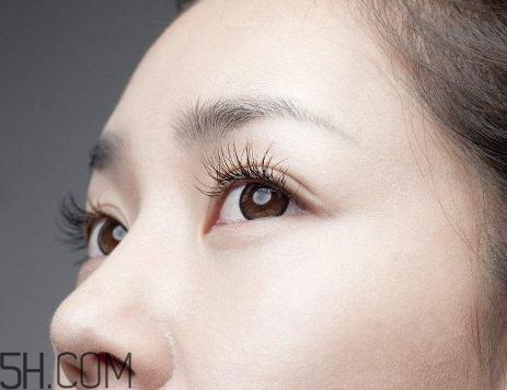 上瞼提肌手術有必要嗎？上瞼提肌后是永久的嗎？