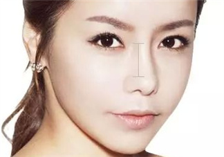 達拉斯隆鼻是什么材料？達拉斯隆鼻怎么樣？