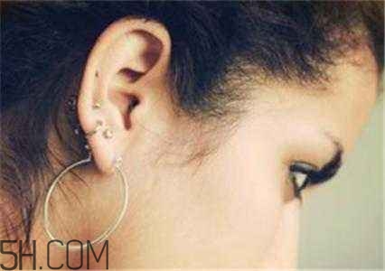 打耳洞后該如何預(yù)防感染？打耳洞前需要注意的細(xì)節(jié)？
