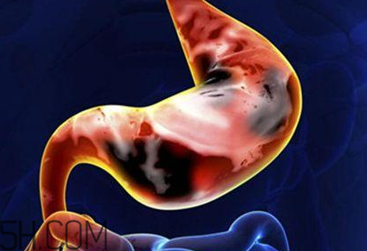 吃太燙會得癌？燙食不僅對胃不好還容易得癌