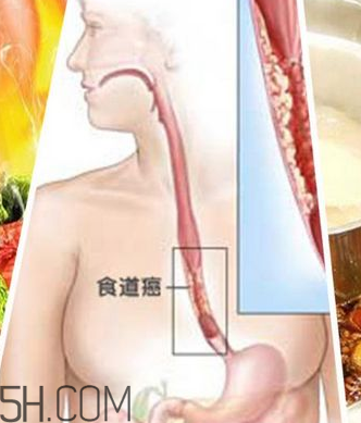 吃太燙會得癌？燙食不僅對胃不好還容易得癌