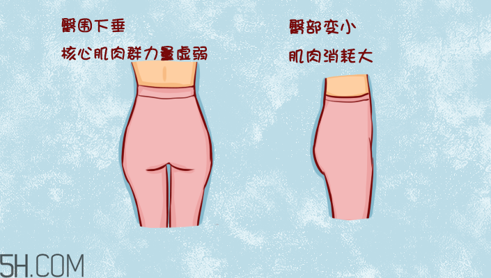 臀部護(hù)理對(duì)健康有什么影響？日常如何保養(yǎng)臀部健康？