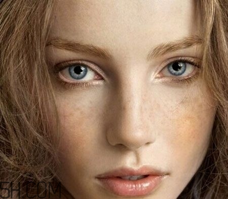 中年女性長斑怎么辦？深究長斑原因