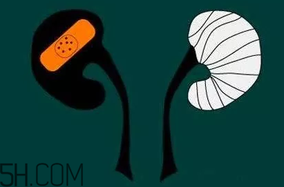 為什么容易得腎炎？慢性腎炎腎衰很難發(fā)現(xiàn)