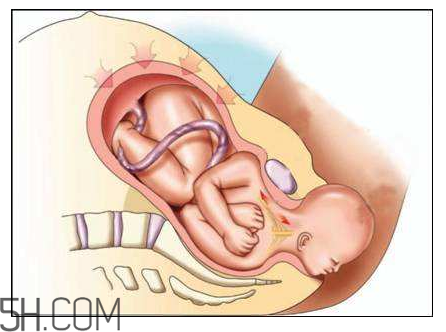 分娩如斷骨？分娩痛感沒那么夸張