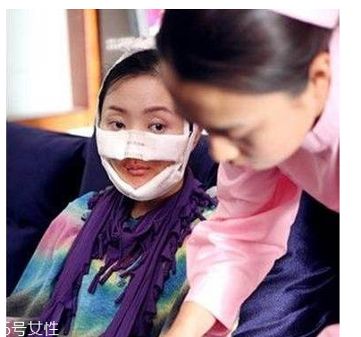 幻丑癥有多可怕？極端時會自戕