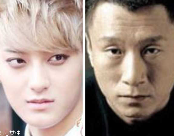 死魚(yú)眼怎么治？割雙眼皮可以治死魚(yú)眼