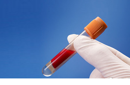 血里的垃圾有哪些？油脂過多成為垃圾油