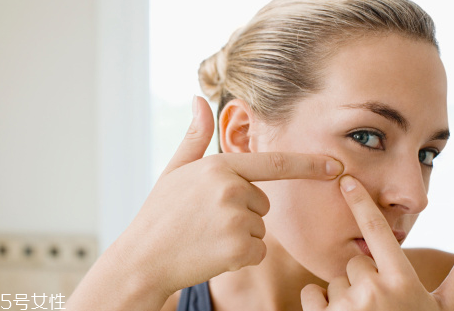 長(zhǎng)痘的根源是什么？原來(lái)是吃糖過(guò)多