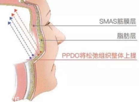 大v線會(huì)斷嗎？一定要選擇正規(guī)整形醫(yī)院
