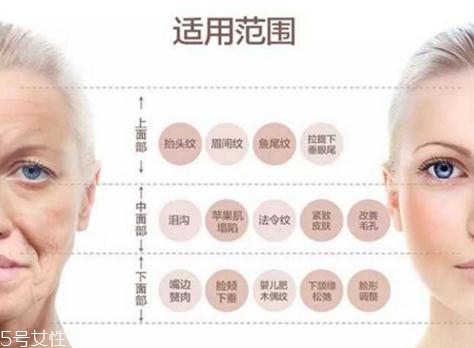 大v線會(huì)斷嗎？一定要選擇正規(guī)整形醫(yī)院