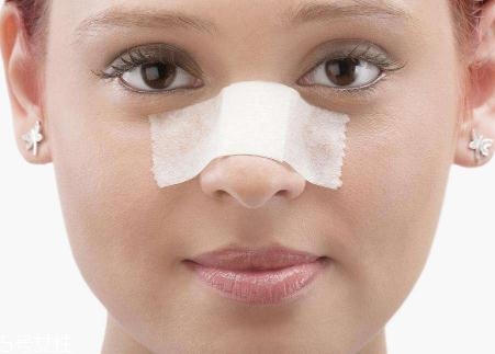 鼻小柱延長(zhǎng)用什么材料？?jī)?yōu)先選擇鼻中隔軟骨