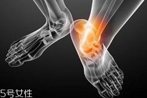 痛風(fēng)跟飲食有關(guān)？痛風(fēng)更多與遺傳有關(guān)