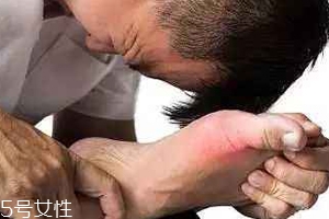 痛風(fēng)可以治愈嗎？無(wú)法治愈但能控制