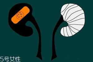 腎病為什么會發(fā)展到尿毒癥？這些因素一定要注意