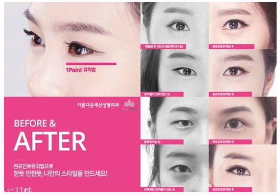 韓國人最愛整哪兒？韓國整形部位TOP4