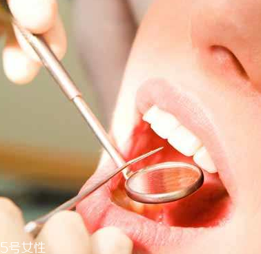 潰瘍的根源在哪里？也許僅僅只是牙膏沒選對