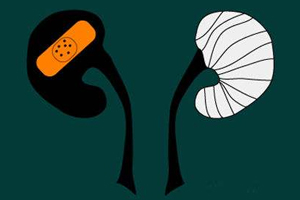 腎病為什么會發(fā)展到尿毒癥？這些因素一定要注意