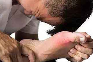 痛風(fēng)可以治愈嗎？無法治愈但能控制