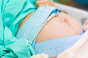 剖腹產(chǎn)坐月子該注意什么？保護(hù)傷口是關(guān)鍵