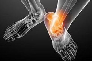 痛風(fēng)跟飲食有關(guān)？痛風(fēng)更多與遺傳有關(guān)